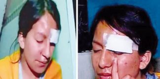 Desfiguran a esposos por celulares y 300 soles