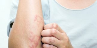 Enfermedades-Raras-y-Huérfanas