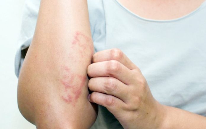 Enfermedades-Raras-y-Huérfanas