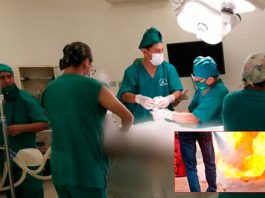 Salvaje prendió fuego a su esposa