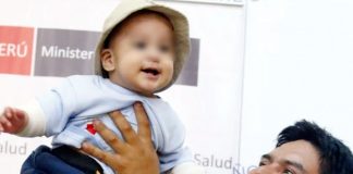 El milagro de un bebé tras infierno en VES El pequeño Nicolás fue sometido a varias intervenciones quirúrgicas debido a las fuertes quemaduras que afectó sus cuatro extremidades