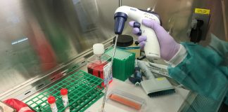 Test para coronavirus (COVID-19)