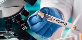 Proveedor donde se adquirió pruebas rápidas no es ilegal Pruebas rápidas Covid-19
