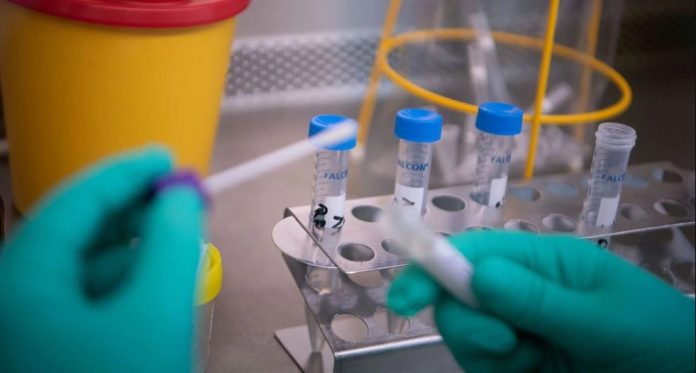 Minsa realizará hasta 12 mil pruebas diarias de coronavirus Minsa realizará hasta 12 mil pruebas diarias de coronavirus