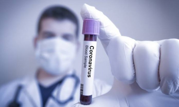 INS crea prueba molecular en menos de una hora INS crea prueba molecular en menos de una hora