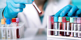Análisis de sangre