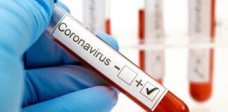 Coronavirus Covid-19