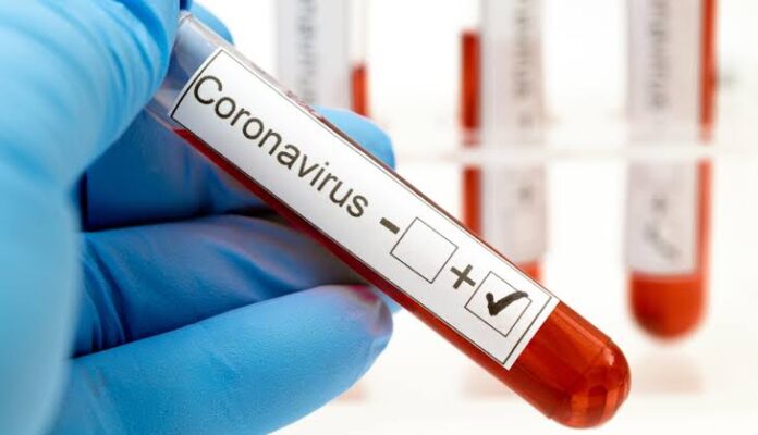 Coronavirus Covid-19