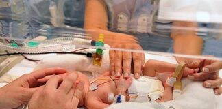 ¿Que es el síndrome de Patau? Síndrome de Patau