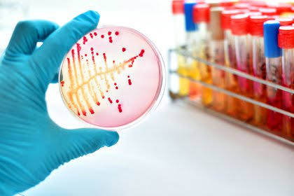 difteria