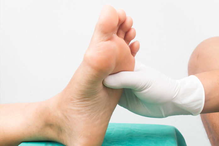 pie diabético pie diabético