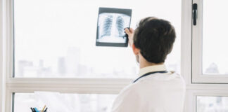 Pulmones