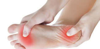 Fascitis plantar