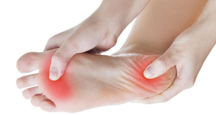 Fascitis plantar