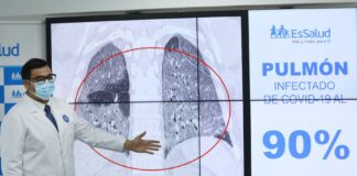 Covid-19 puede afectar pulmones en sólo 5 días