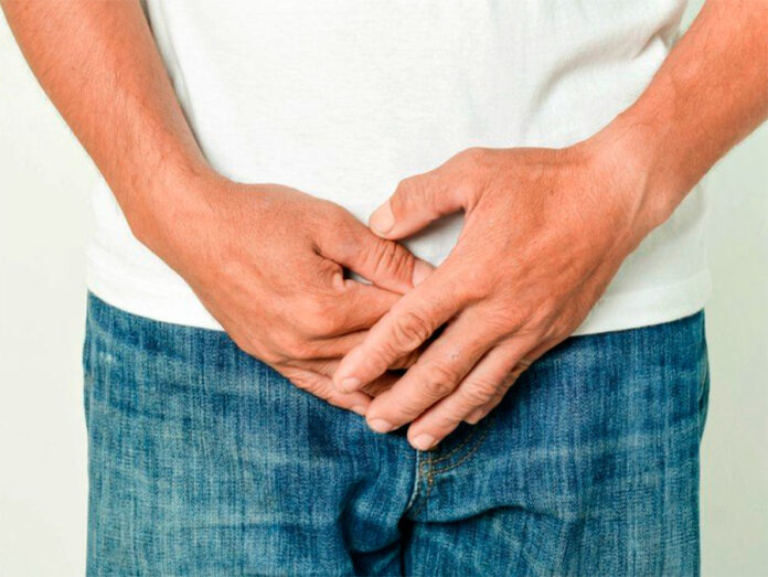 Cálculos a la vejiga