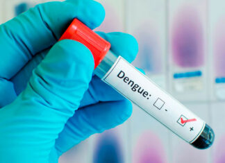 Dengue