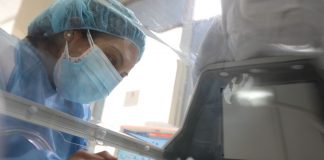 Nacen siameses en Arequipa