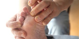 hongos en los pies