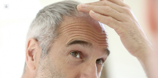 pérdida de cabello