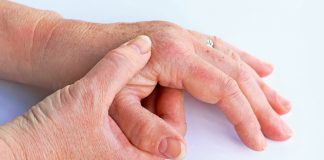 Psoriasis