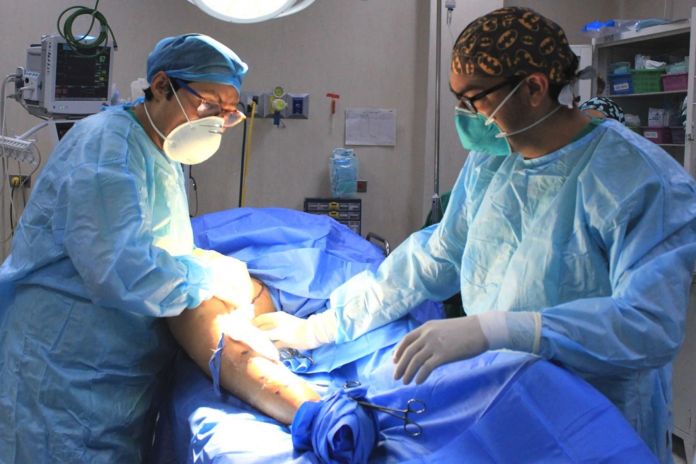 várices