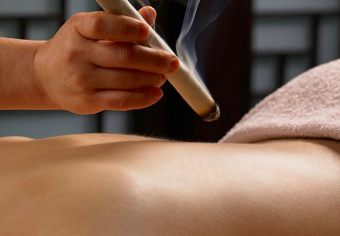 Moxibustión directa