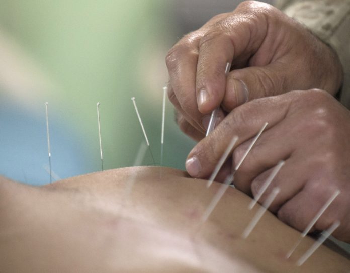 Acupuntura