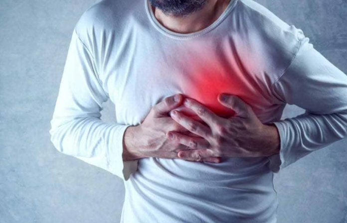 Infarto