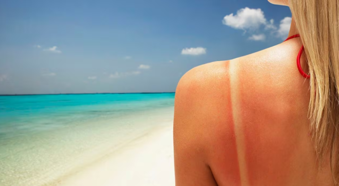 Minsa: exponerte al Sol generaría daños oculares