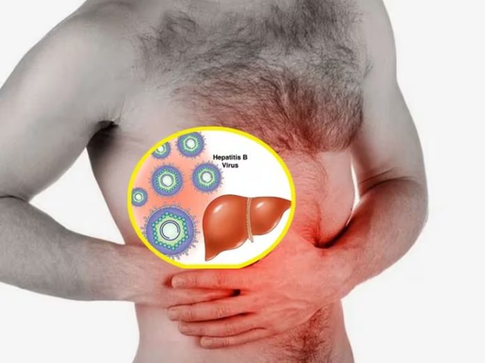 135 mil peruanos portan en su cuerpo la Hepatitis B