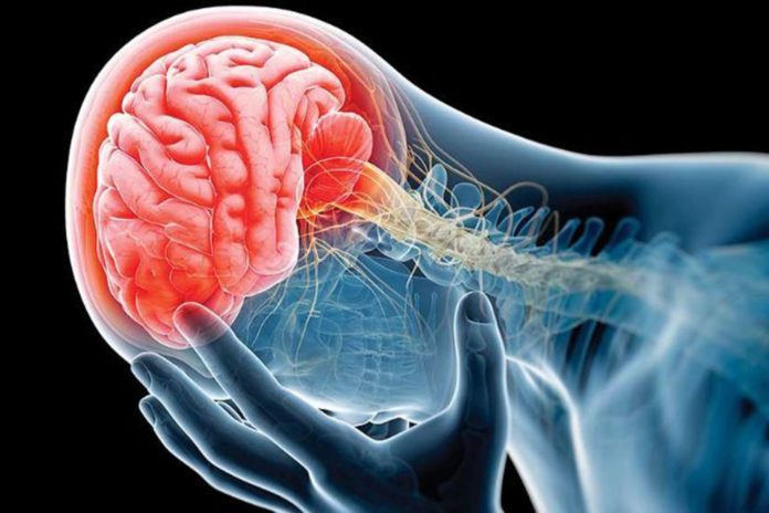 Día Mundial del Cerebro: conoce las enfermedades más comunes