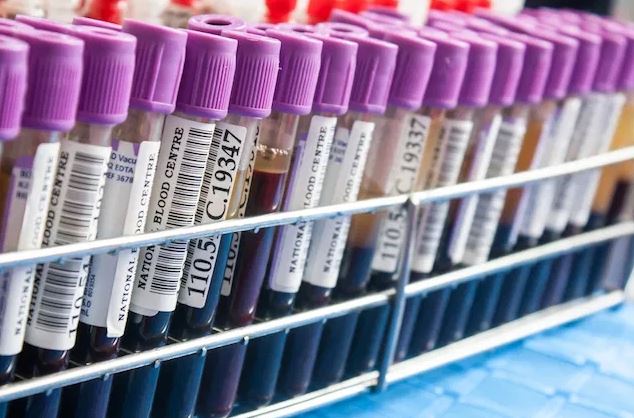 análisis de sangre análisis de sangre