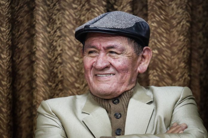 Fallece Hugo 
