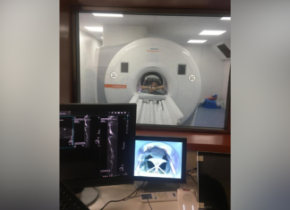 Minsa compra equipos de rayos X con inteligencia artificial