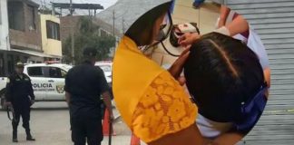 Bala perdida impactó en cara de niña