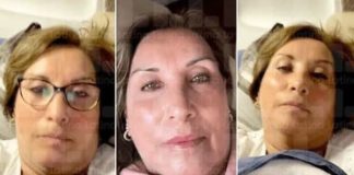 “Dina se hizo cirugía a cambio de favores” Dina Boluarte