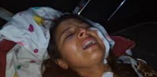 Le cortan la cara y salen en libertad