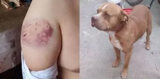 Pitbull destroza a menor de edad