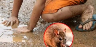 leptospirosis