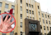 Minsa debe ponerse pilas y evitar brote de sarampión