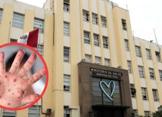 Minsa debe ponerse pilas y evitar brote de sarampión