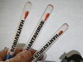 hantavirus