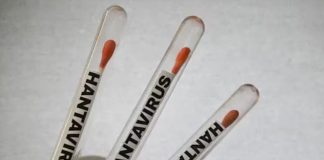 hantavirus