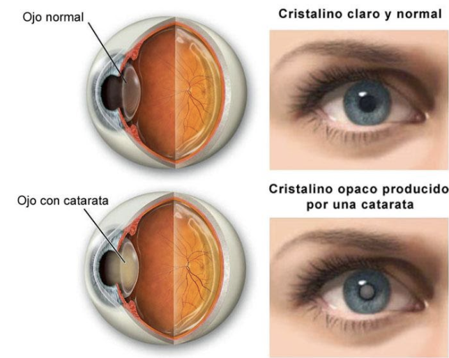 Cataratas