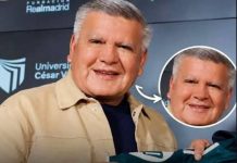 César Acuña se estira la cara y lo comparan con Jimmy Santi
