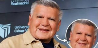 César Acuña se estira la cara y lo comparan con Jimmy Santi