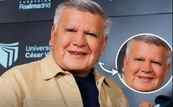 César Acuña se estira la cara y lo comparan con Jimmy Santi