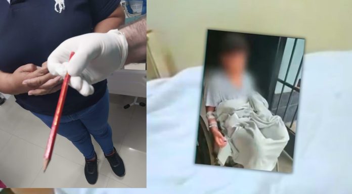 Perforan intestino a escolar de 11 años